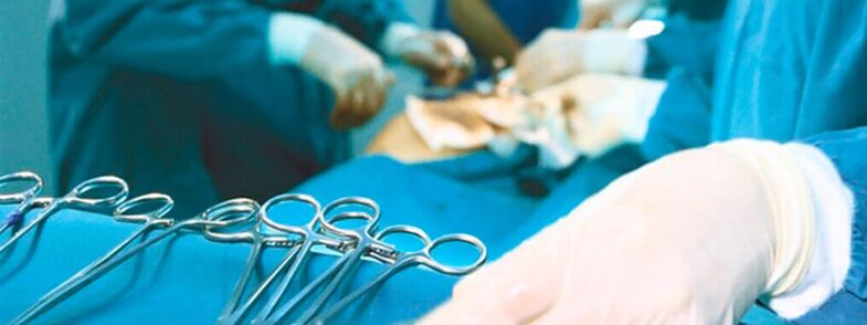 Операција проширења пениса коју изводи хирург